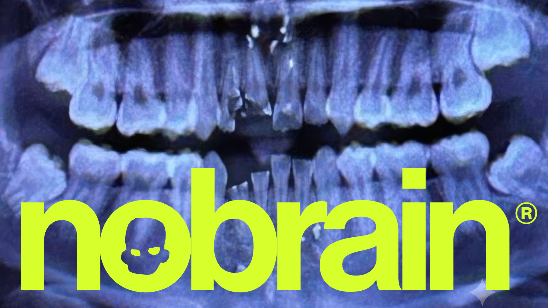 Nobrain logo set against a dental X-ray
